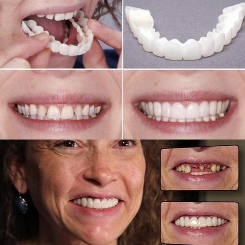 Magic Teeth Brace 2PCS