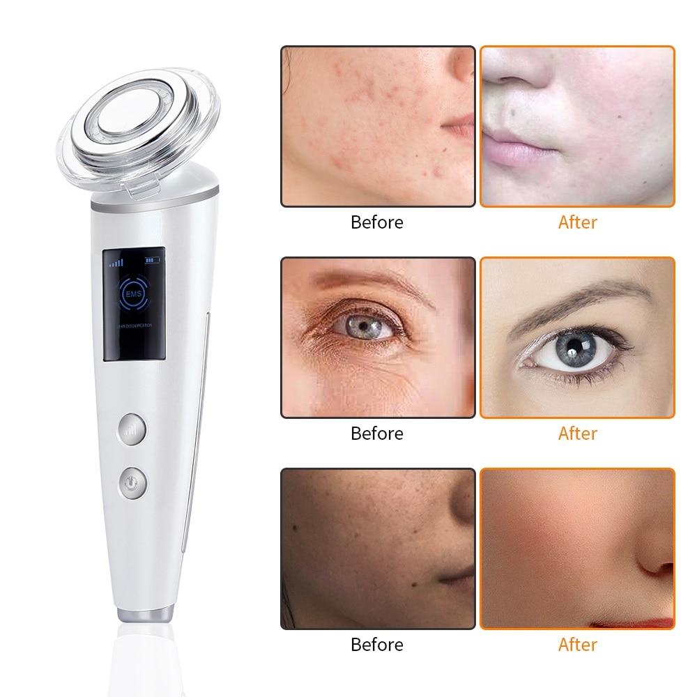 Galvanic EMS LED Photon Light Therapy Beauty Device Skin Care Face Lifting Tightening Facial Machine With LCD Rf Radio Frequency