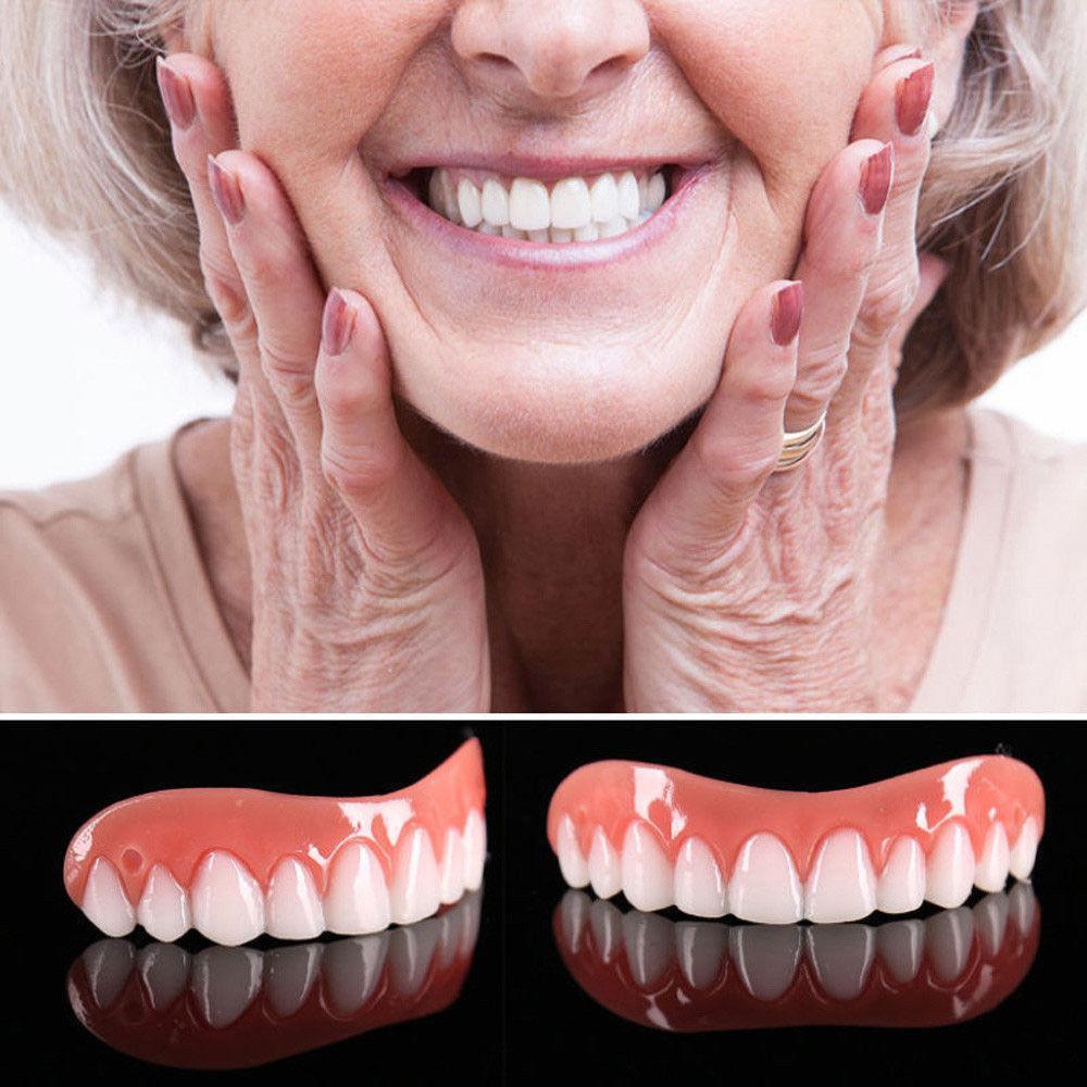 Magic Teeth Brace Veneer