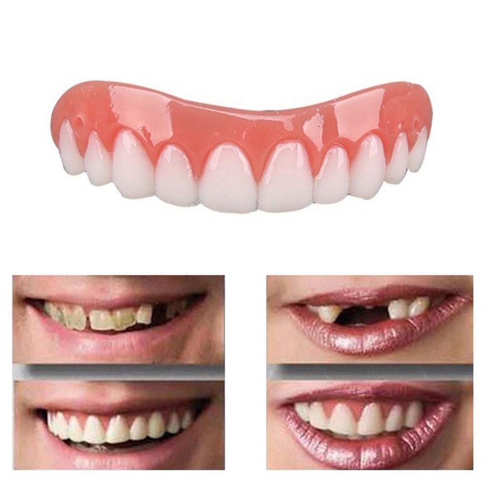 Magic Teeth Brace Veneer