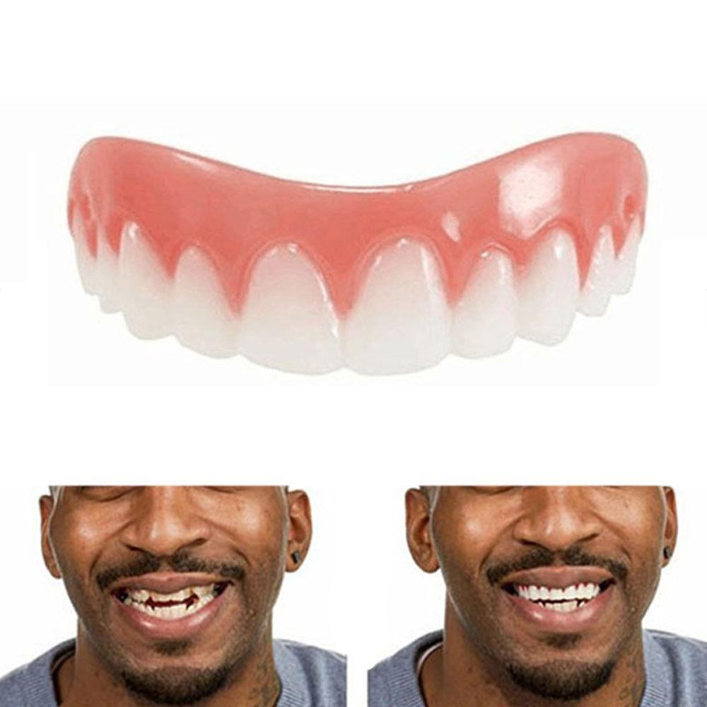 Magic Teeth Brace Veneer